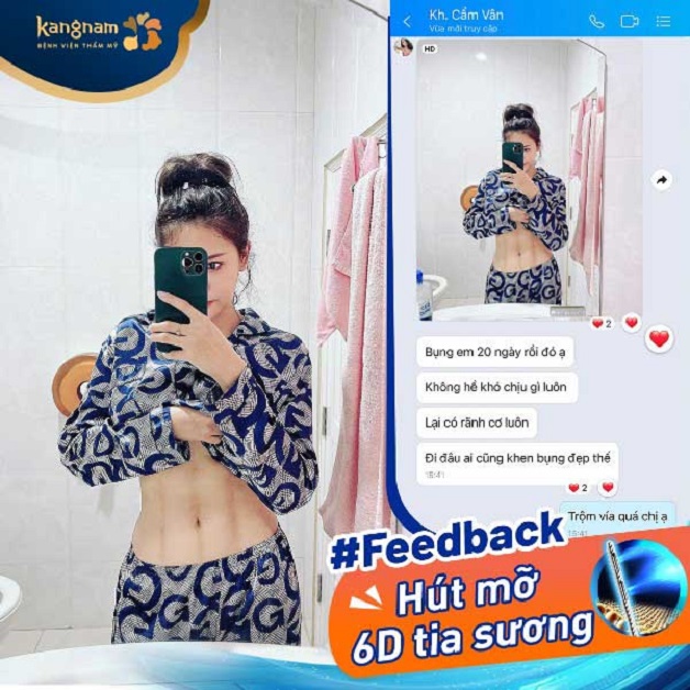 Chị Cẩm Vân gửi feedback sau giảm mỡ bụng công nghệ 6D tia sương