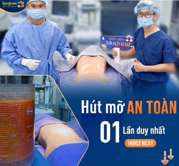 Dịch vụ hút mỡ tại Viện thẩm mỹ Kangnam Cần Thơ