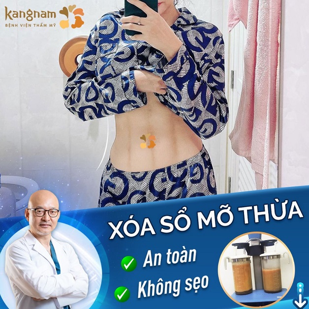 Địa chỉ hút mỡ ở Đà Nẵng - Viện thẩm mỹ Kangnam Đà Nẵng