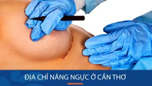 Địa chỉ nâng ngực kangnam Cần Thơ – Công nghệ hiện đại cho vòng 1 hoàn hảo