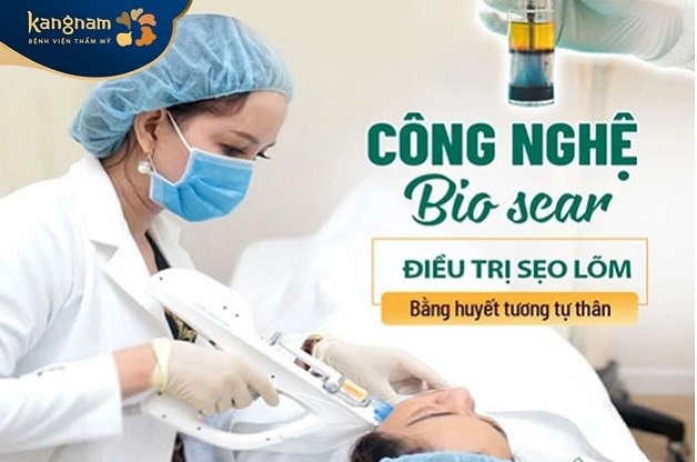 Điều trị sẹo công nghệ Bio Scar
