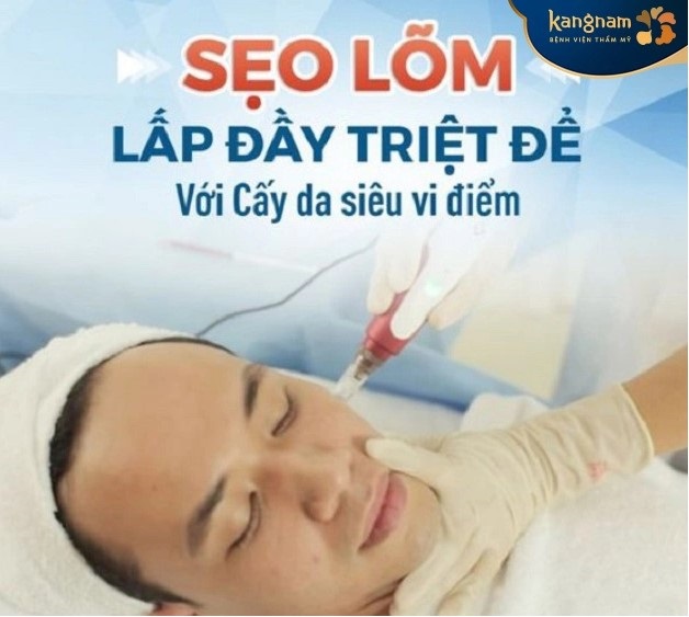 Cấy da siêu vi điểm trị sẹo lõm