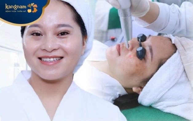 Công nghệ trị tàn nhang Laser toning
