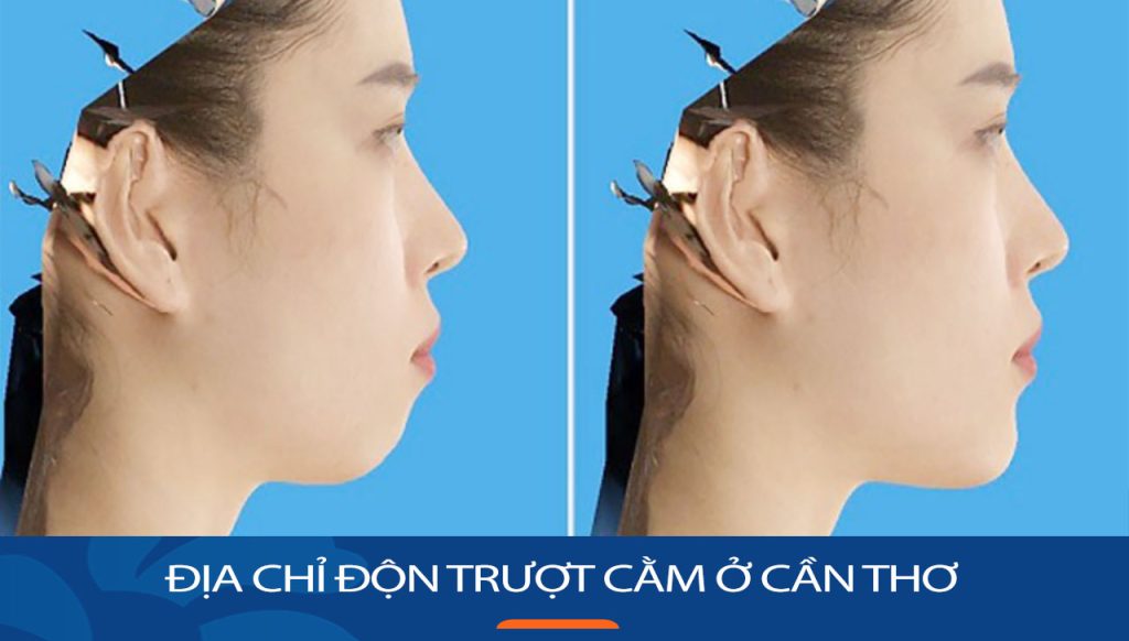 Địa chỉ Trượt cằm kangnam Cần Thơ
