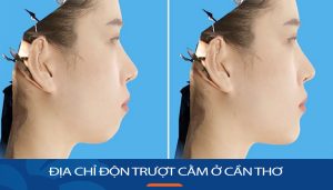Địa chỉ Trượt cằm kangnam Cần Thơ