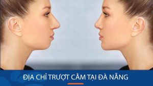 Trượt cằm kangnam Đà Nẵng