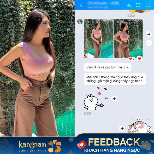 Bạn Khánh Ngọc chia sẻ sau 1 tháng nâng ngực