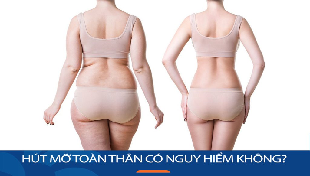 Hút mỡ toàn thân có nguy hiểm không? Những lưu ý quan trọng