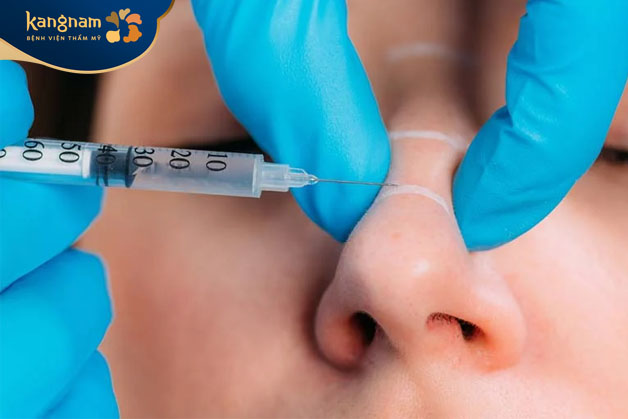 Lựa chọn địa điểm làm đẹp uy tín là cách tốt nhất để đảm bảo tiêm filler mũi an toàn