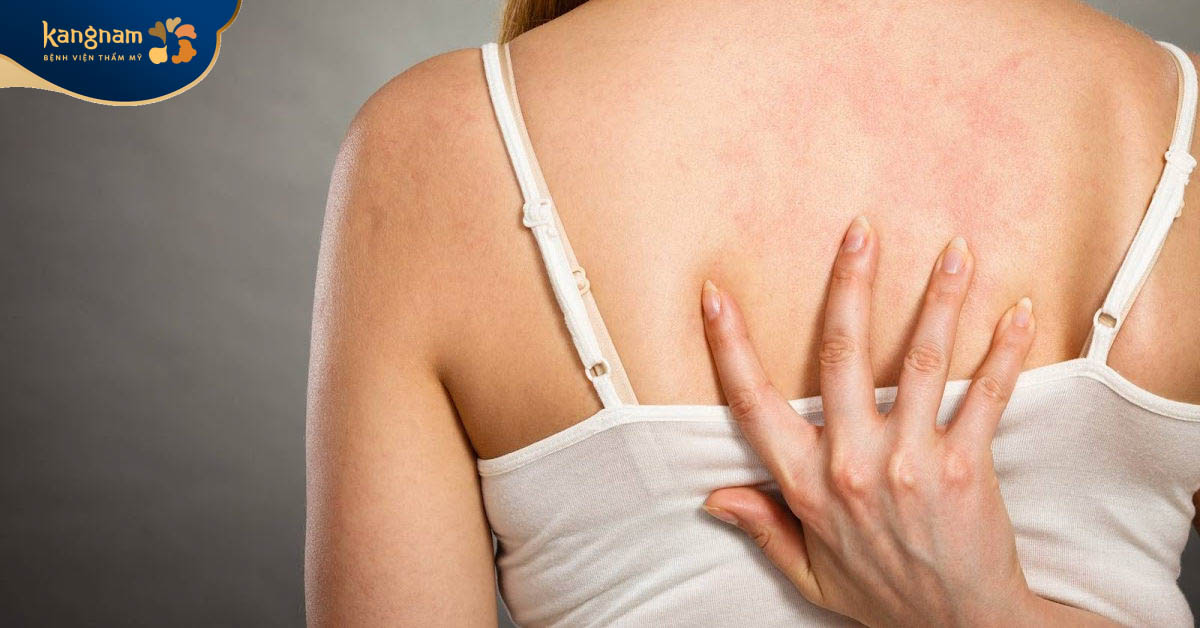 Ngứa ngáy triệu chứng nhận biết