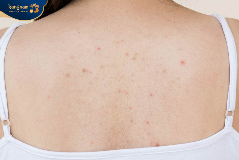 Vệ sinh cơ thể sạch sẽ