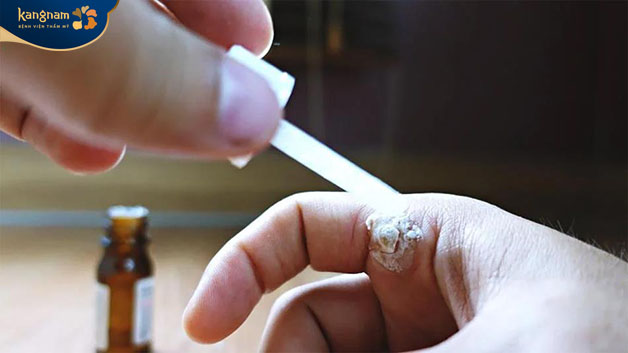 Thuốc sẽ làm ức chế sự phát triển của tế bào mụn trên da 