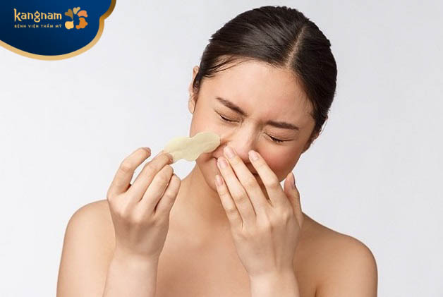 Không nên lột mụn đầu đen