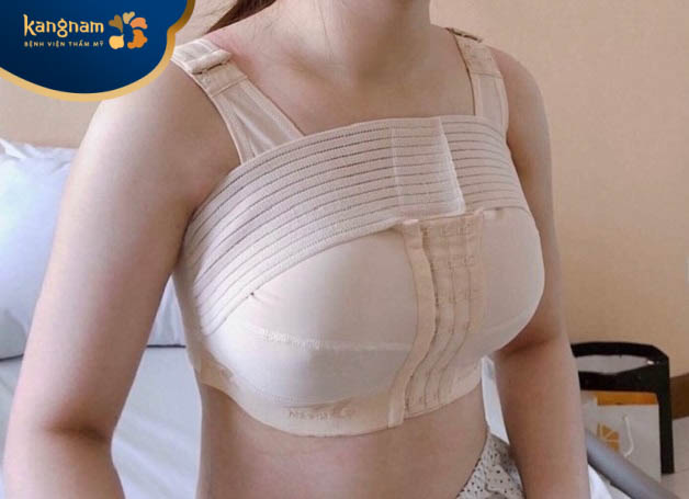 Mặc áo định hình ít nhất 2 tháng đầu sau nâng ngực