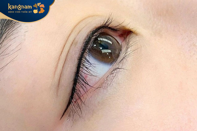 Phun mí là phương pháp làm đẹp an toàn