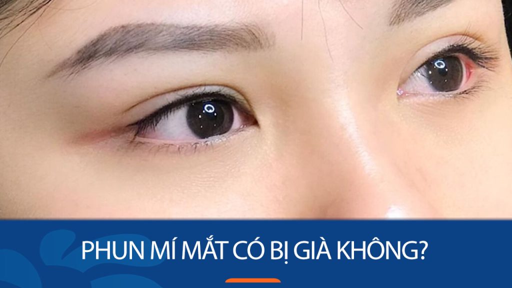 Phun mí mắt có bị già không? cần lưu ý điều gì