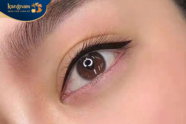 Phun mí có thể thực hiện ở nhiều độ tuổi khác nhau