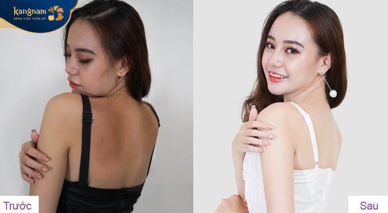 Cải thiện làn da thâm sạm, da đẹp không tì vết và khỏe khoắn hơn.