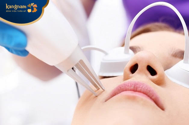 Công nghệ điều trị sẹo rỗ laser CO2