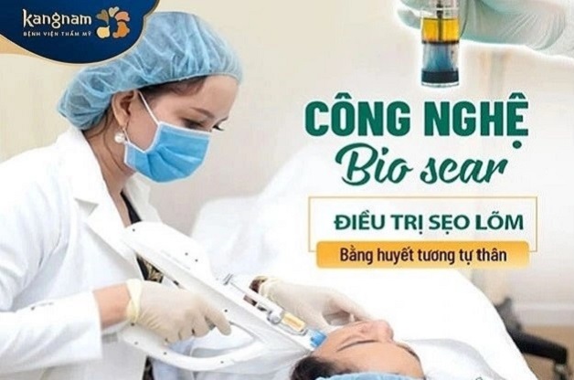 Trị sẹo rỗ Bio Scar