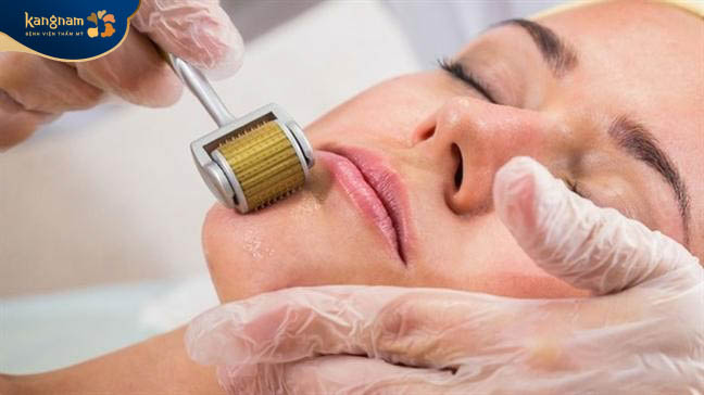 Sử dụng đầu kim nhỏ để trị sẹo