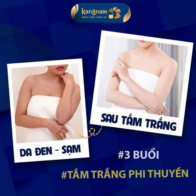 Da đen sạm, không đều màu trắng bật tone sau 3 buổi