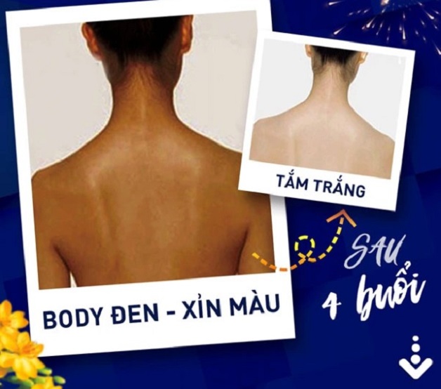 Một liệu trình tắm trắng da công nghệ phi thuyền Hi-white trung bình gồm 4 buổi