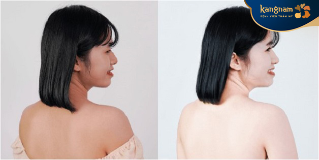 Da đều màu, lỗ chân lông thu nhỏ sau tắm trắng