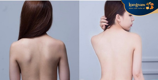 Da sáng mịn màng, không tì vết