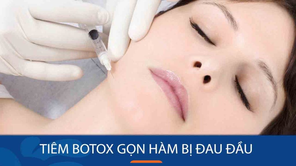 Tiêm botox gọn hàm bị đau đầu: Cách phòng ngừa biến chứng
