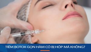 Tiêm botox gọn hàm có bị hóp má không?một số lưu ý quan trọng