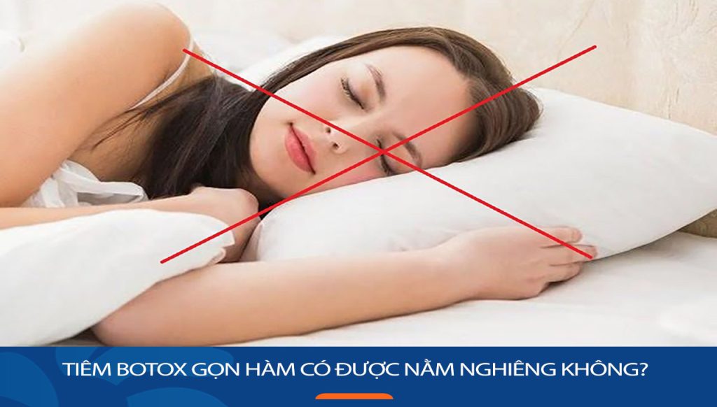 Tiêm botox gọn hàm có được nằm nghiêng không? Giải đáp thắc mắc từ chuyên gia