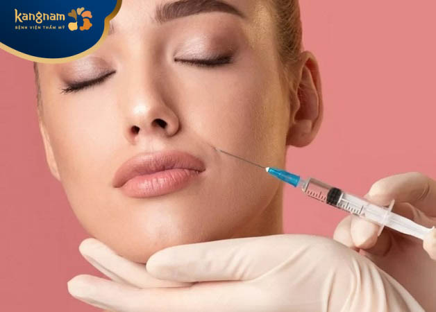 Cần từ 1CC đến 3CC để tiêm filler xóa nhăn rãnh cười