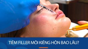 Tiêm filler môi kiêng hôn bao lâu? Giải đáp chi tiết từ chuyên gia