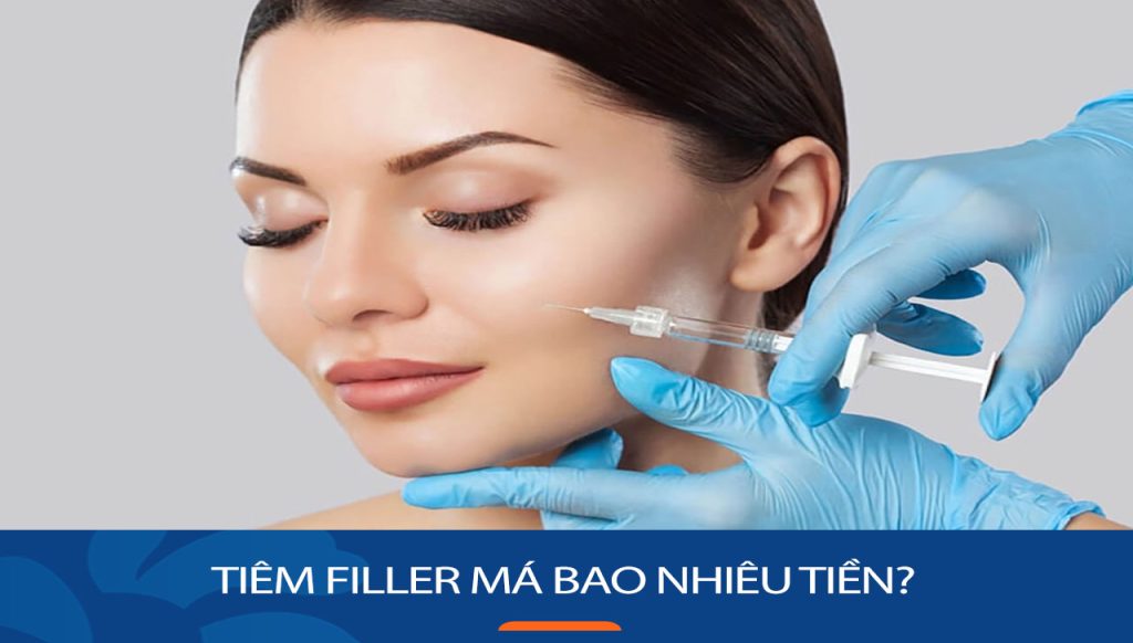 Tiêm filler má bao nhiêu tiền? Bảng giá cập nhật 2024