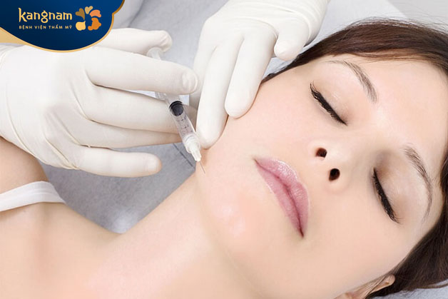 Tiêm filler sẽ ổn định và đẹp sau 1-2 ngày