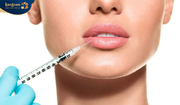 Bác sĩ sẽ sử dụng một kim tiêm nhỏ để bơm filler HA vào vùng môi