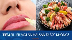 Tiêm filler môi ăn hải sản được không? Nên và không nên ăn hải sản