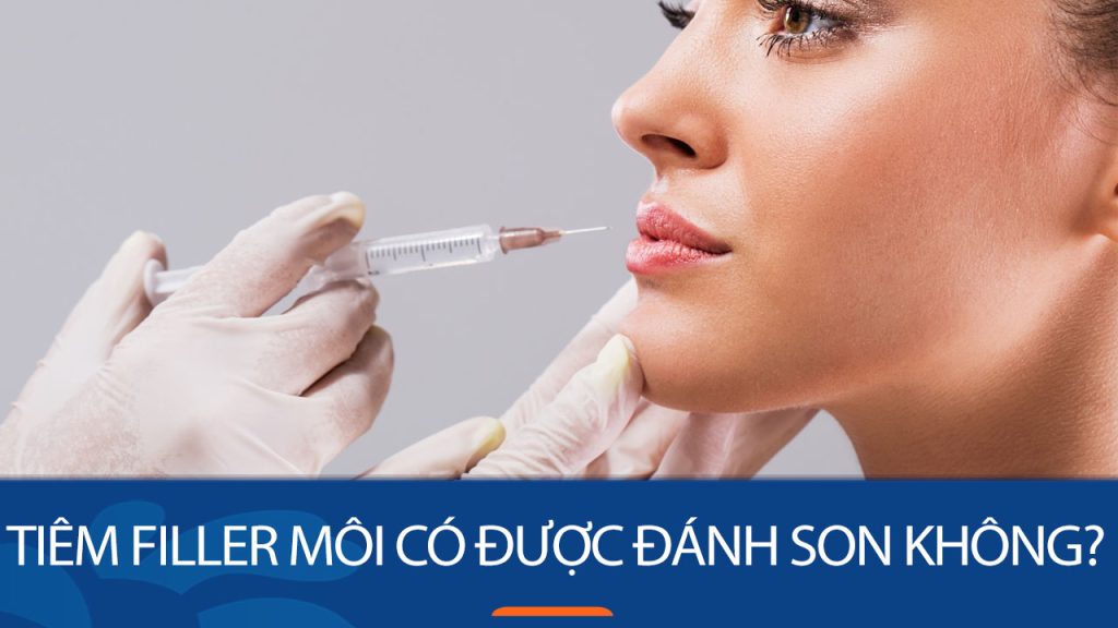 Sau khi tiêm filler môi bao lâu thì có thể đánh son?Lưu ý khi đánh son