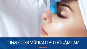 Tiêm filler mũi bao lâu thì dặm lại? Lưu ý để có kết quả lâu dài