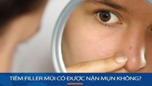 tiêm filler mũi có được nặn mụn không