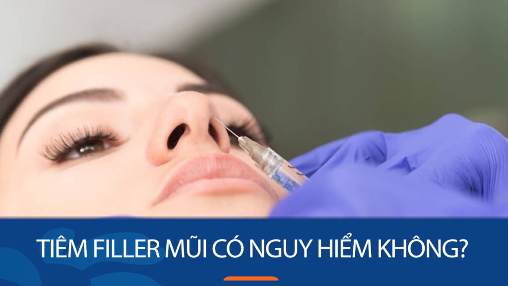 Tiêm filler mũi có nguy hiểm không? Giải đáp mọi thắc mắc