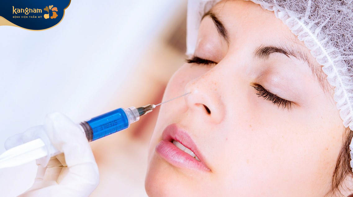 Tiêm filler mũi có tốt và an toàn