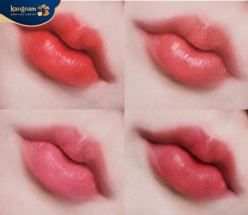 Đôi môi căng mọng "kẹo ngọt" giúp bạn trẻ trung hơn