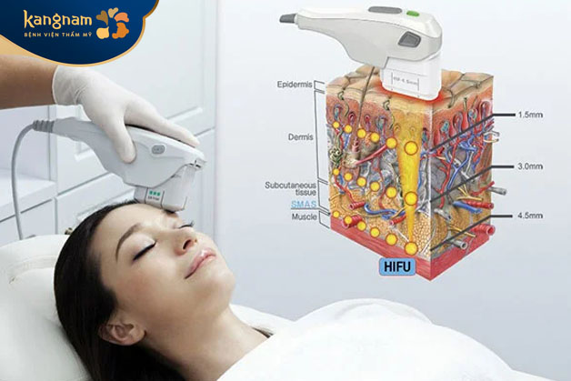 Trẻ hóa da đa tầng