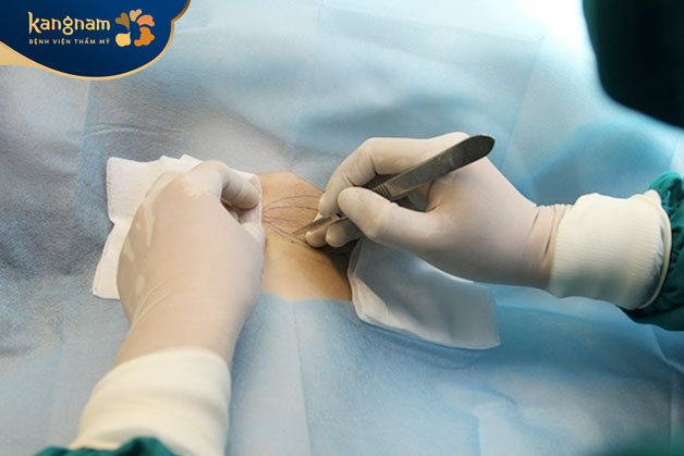 Endo Dry có tỷ lệ thâm nhập thấp, không làm tổn thương cấu trúc mô mềm