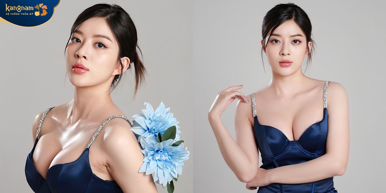 Sau phẫu thuật, Lan Hương xuất hiện với visual cực xịn