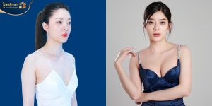 Gen Z “cãi lời” bố mẹ đi thẩm mỹ vì muốn hoàn hảo hơn