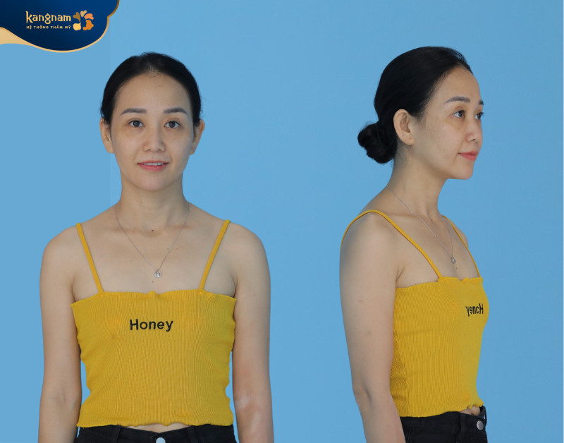 Vòng một gần như “phẳng lì” khiến Ngọc Thúy thiếu đi nét quyến rũ