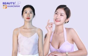 Mẹ bỉm 9x thẩm mỹ để thoát khỏi vùng an toàn